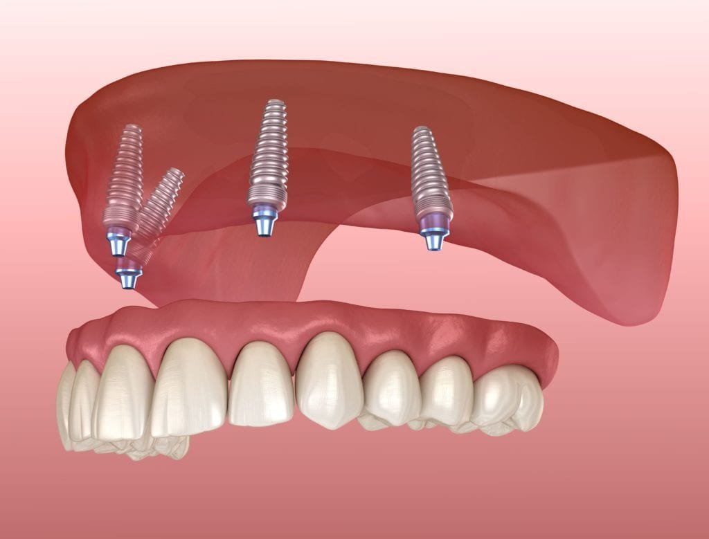 img-fluid img-thumbnail rounded course-image